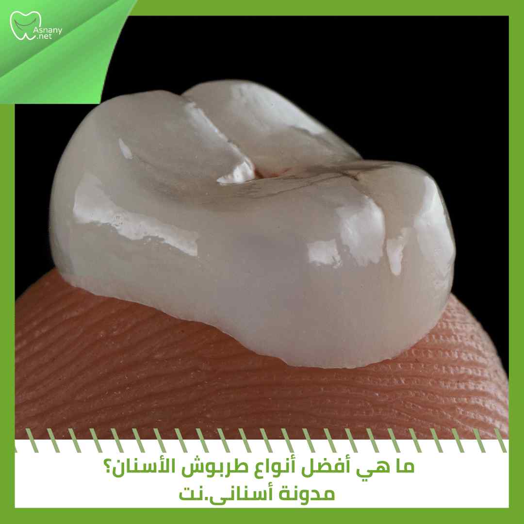 ما هي أفضل أنواع طربوش الأسنان؟