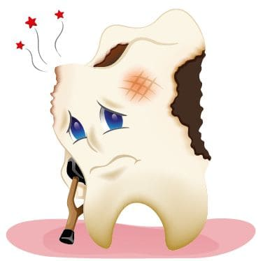 تسوس الأسنان الأمامية: الأسباب، والمراحل، وأحدث طرق العلاج والوقاية